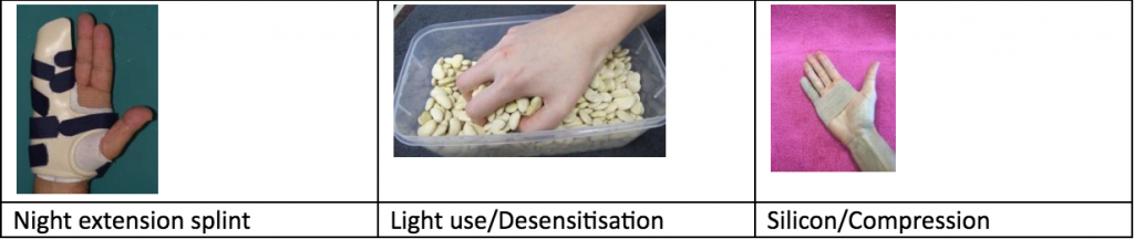 Dupuytren's Contracture