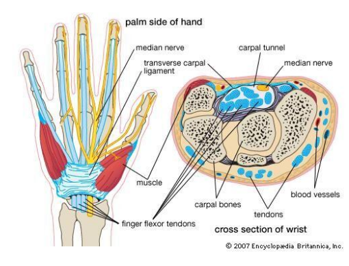 carpal tunnel syndrome during pregnancy