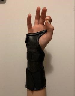 Custom Orthosis - Static Orthosis