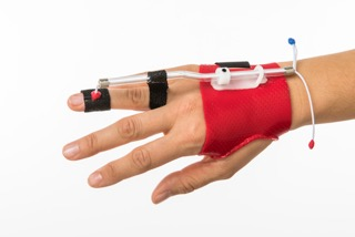 Custom Orthosis - Dynamic Orthosis