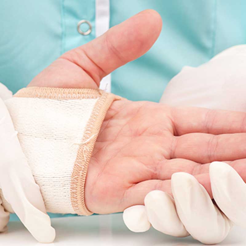 travel after hand surgery